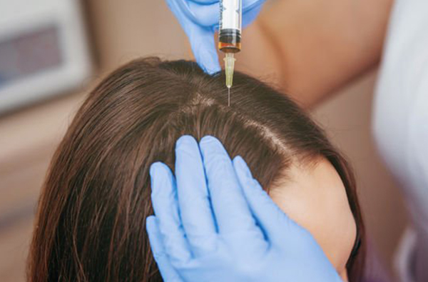 Bingöl PRP Saç Ekimi Klinikleri